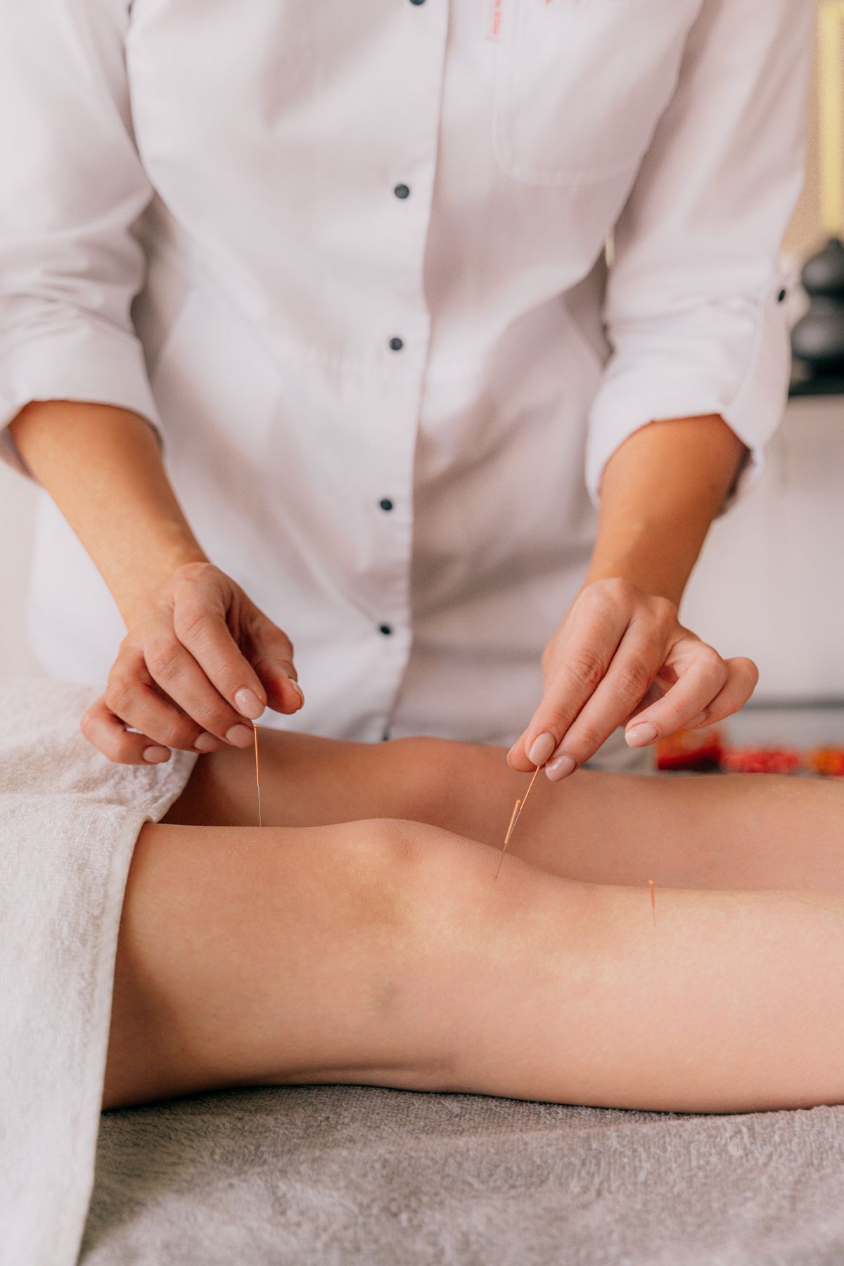 Dry needling near the knee during physical therapy
